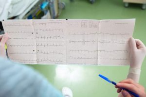 Doctor looking at EKG